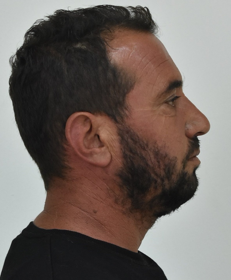 κολωνός βιασμός, 12χρονη, ιωαννης σοφιανιδης