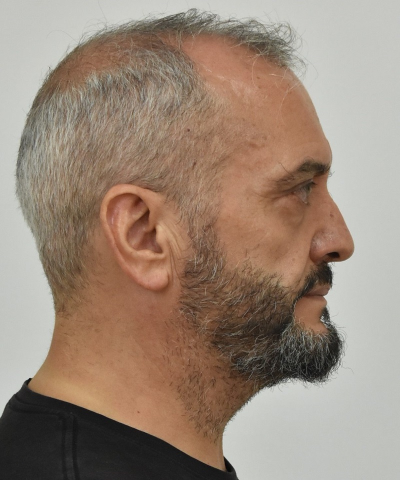 κολωνός, σεπολια, παιδεραστής, ηλιας μιχος