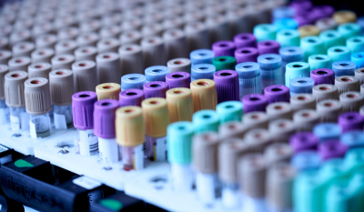 Ανοσία στον κορονοϊό: Επιστήμονες ανέπτυξαν «PCR αίματος» που μετράει τα Τ κύτταρα