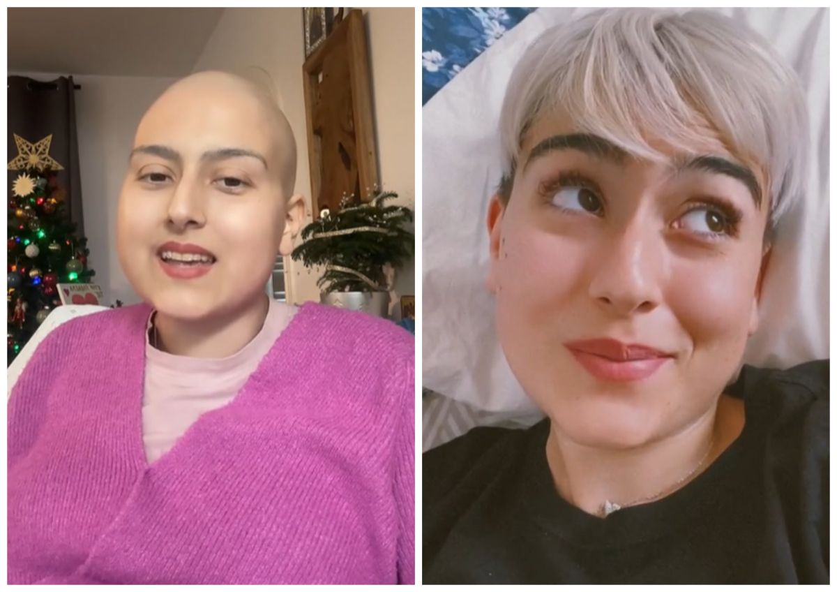 Πέθανε η 21χρονη Ραφαέλα Πιτσικάλη μετά από μάχη με σπάνια μορφή καρκίνου - Έπασχε από Σάρκωμα Ewing