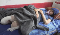 Η φρίκη της Γάζας: «Ξαναβάλτε μου τα πόδια» - Γροθιά στο στομάχι τα δάκρυα 13χρονου κοριτσιού