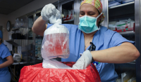 Εικόνες και βίντεο από την πρώτη μεταμόσχευση νεφρού από χοίρο σε άνθρωπο