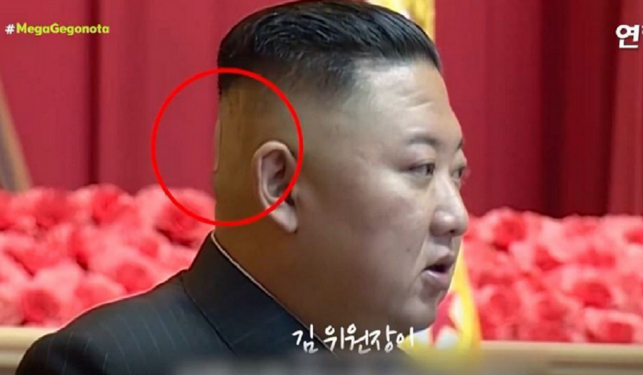 «Μυστηριώδες» τσιρότο στο κεφάλι του Κιμ Γιονγκ Ουν – Οργιάζουν τα σενάρια για την υγεία του