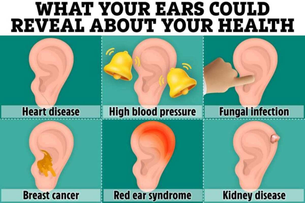 Από τους λοβούς με πτυχώσεις έως τη φαγούρα - Τι μπορούν να αποκαλύψουν τα αυτιά μας για την υγεία μας