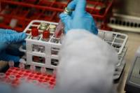Γερμανία: Οι ΗΠΑ αφήνουν υπόνοιες ότι η πανδημία ξεκίνησε από εργαστήριο