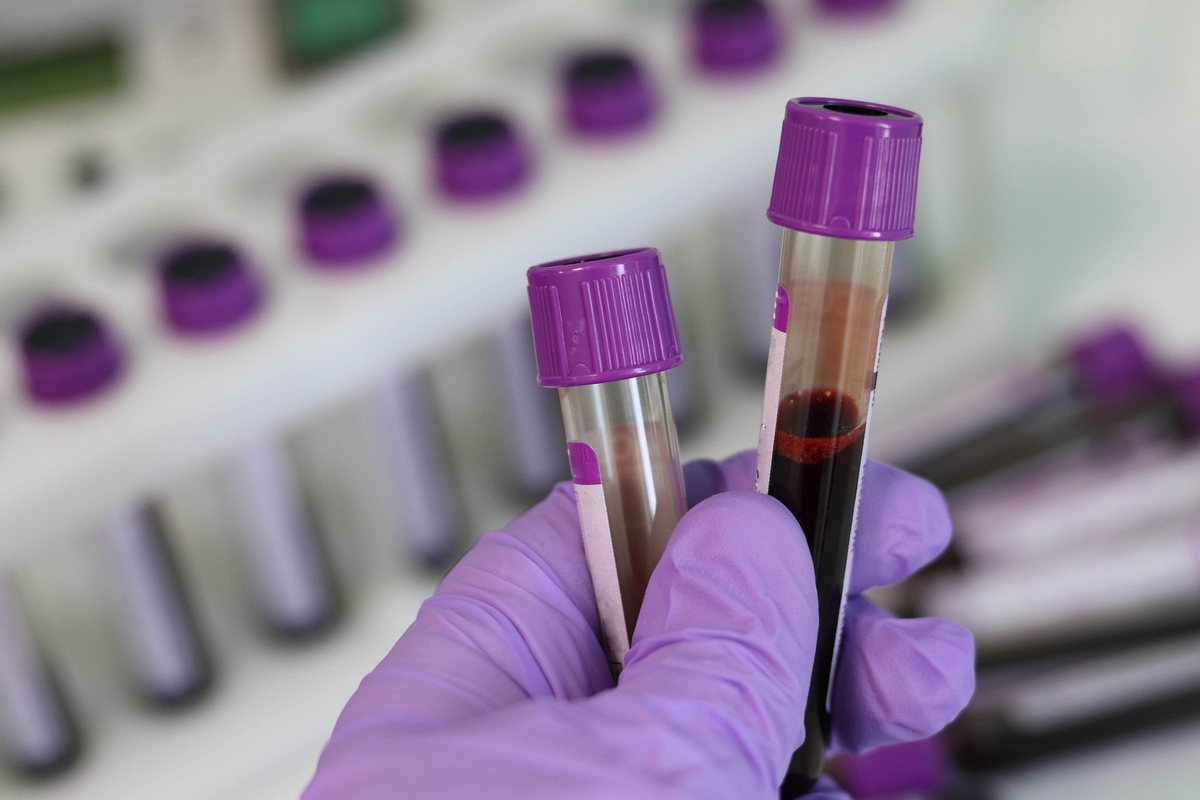 Έρευνα: Νέο τεστ αίματος μπορεί να προβλέψει την σοβαρή νόσηση από κορονοϊό