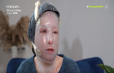 Ιωάννα Παλιοσπύρου: Η επίπονη καθημερινότητά της, οι μάσκες και τα κατεστραμμένα ρούχα από την επίθεση