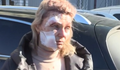 Πόλεμος στην Ουκρανία: Η αιματοβαμμένη γυναίκα που έγινε viral παρακαλεί τον Πούτιν να σταματήσει το μακελειό