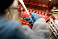 Επιφυλάξεις Δημόπουλου για το ρωσικό εμβόλιο - Πότε αναμένονται αποτελέσματα από τις άλλες μελέτες