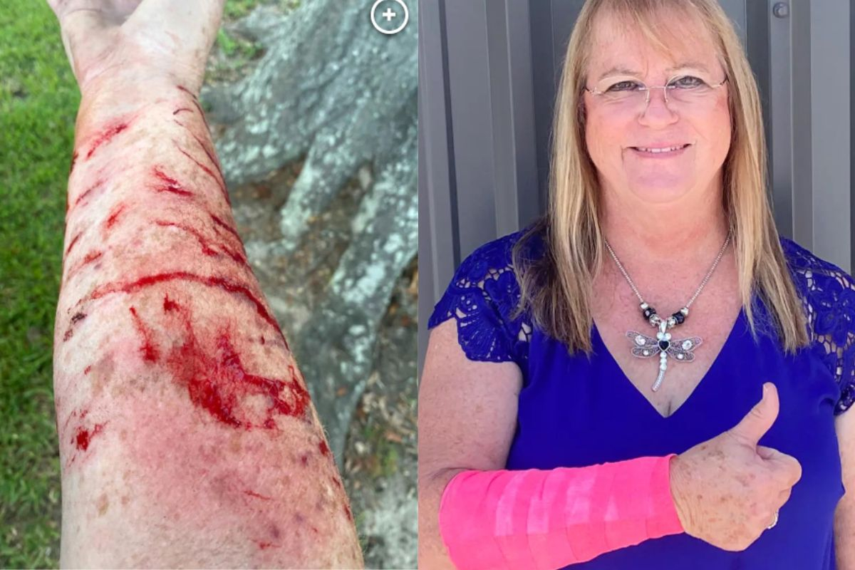 Τέξας: Μια 64χρονη δέχθηκε επίθεση από γεράκι και φίδι ταυτόχρονα