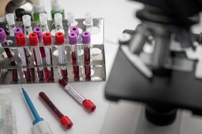 Μόσιαλος: Έγινε η πρώτη δοκιμή εμβολίου για τον κορονοϊό στην Ευρώπη