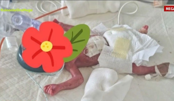 Πάτρα: Μωράκι γεννήθηκε 600 γραμμάρια και βγήκε από τη θερμοκοιτίδα μετά από 159 ημέρες