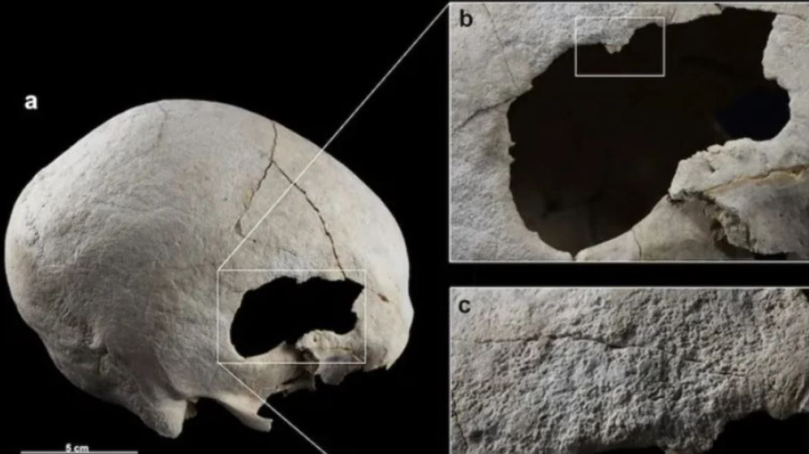 Spain: Scientists found an ancient skull with two holes