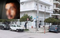 Αργυρούπολη: Χαροπαλεύει η 40χρονη που ξυλοκοπήθηκε από τον σύντροφό της