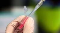 Εμβόλιο Οξφόρδης: Πιθανό να είναι έτοιμο ως το τέλος του 2020
