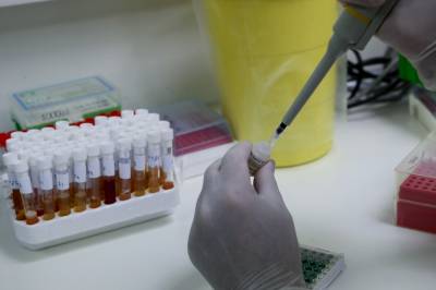 Μπλόκαραν τα τεστ για κορονοϊό -Το Εθνικό Κέντρο Αιμοδοσίας ζητά να μην σταλούν άλλα
