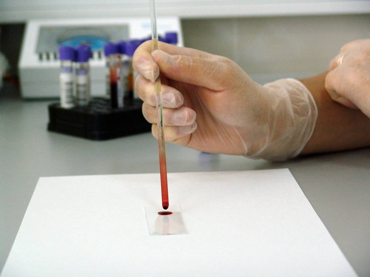 «Έξυπνο» τεστ αίματος ανιχνεύει με ακρίβεια πάνω από 50 είδη καρκίνου