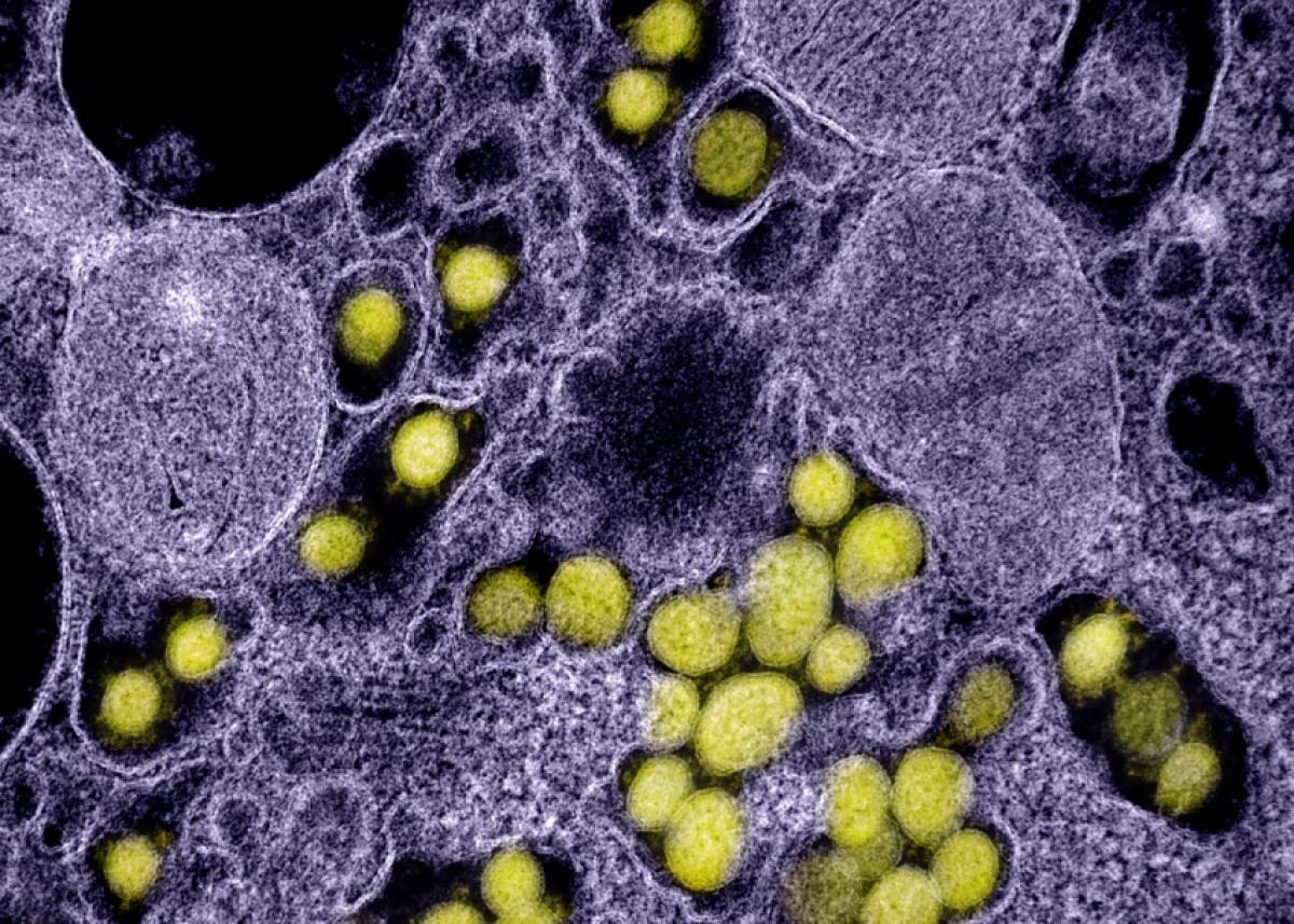 Νέοι και κορονοϊός: Πώς οι κυτταροκίνες οδηγούν σε σοβαρή νόσηση covid-19