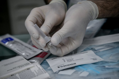 Σκέρτσος: Τέλος τα δωρεάν self test από τα φαρμακεία - Θα υπάρξουν νέα κανάλια διανομής