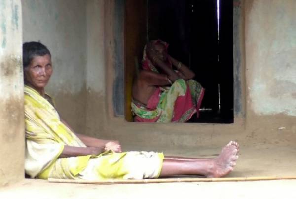 Γυναίκα στην Ινδία με 12 δάκτυλα στα χέρια και 20 στα πόδια