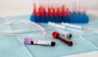 Νέο τεστ αίματος προβλέπει τον κίνδυνο εμφράγματος και εγκεφαλικού στα επόμενα τέσσερα χρόνια