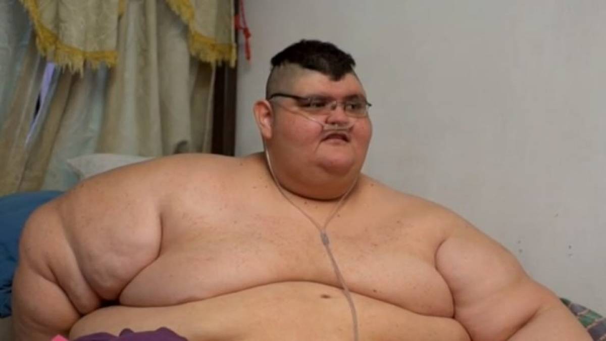 Ο πιο χοντρός άντρας του κόσμου έμεινε μισός σε τρία χρόνια