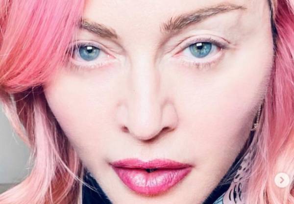 Madonna: Δείχνει την ουλή από την εγχείρηση στο ισχίο της