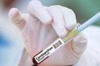 Κορονοϊός: Το δεύτερο ρωσικό εμβόλιο EpiVacKorona θα διατεθεί προς χρήση μέχρι το τέλος του 2020