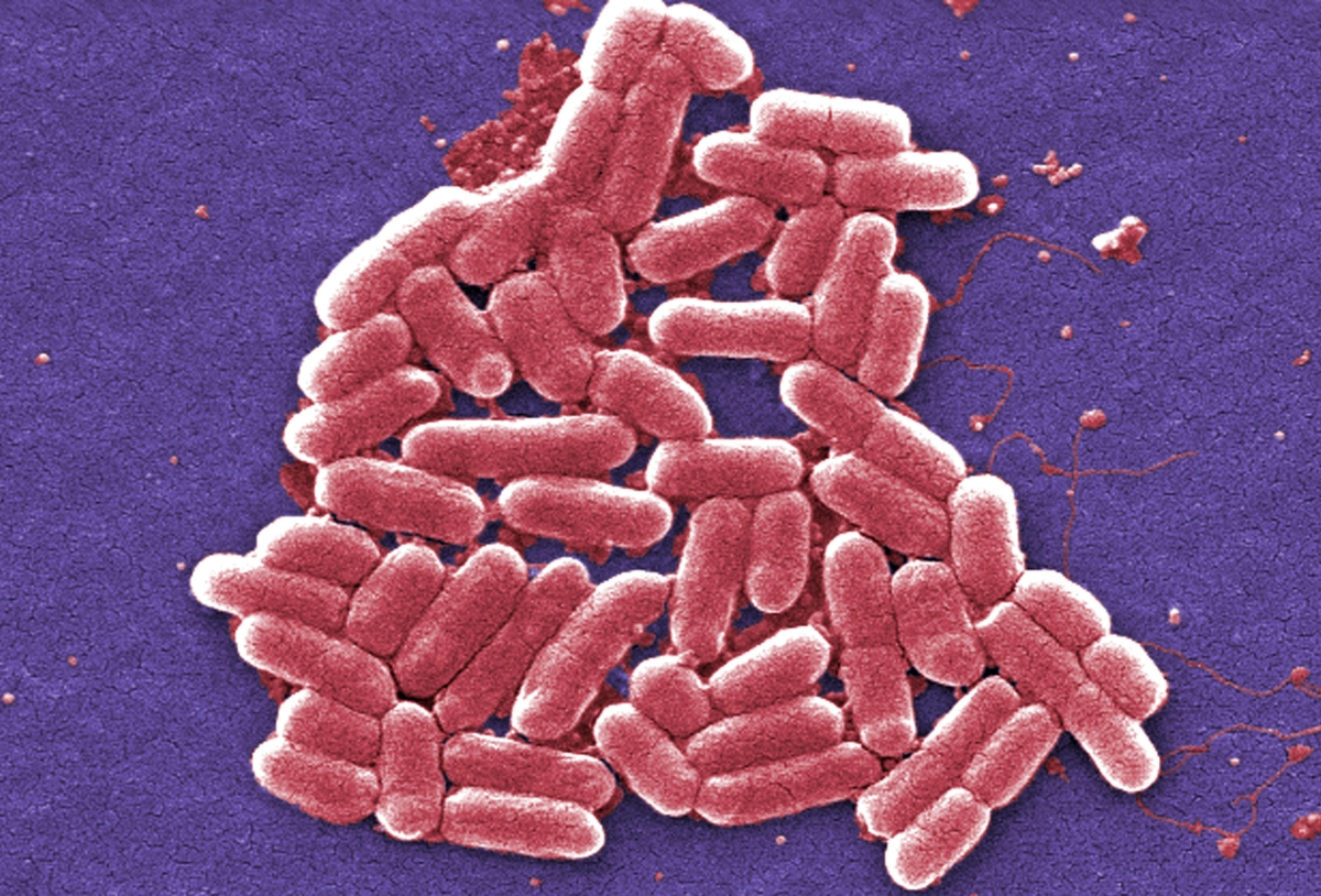 Δραματική προειδοποίηση: Η άνοδος των υπερμικροβίων θα κάνει την πανδημία του Covid να μοιάζει «ασήμαντη»