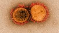 Κορονοϊός: Πώς προσβάλλει η πρωτεΐνη «άγκιστρο» του ιού τα κύτταρα