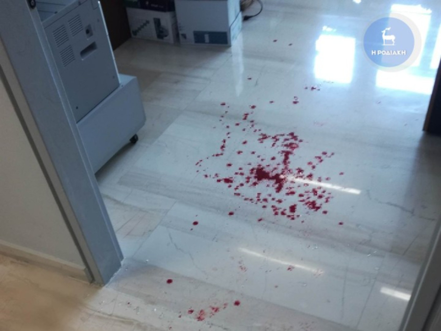 Αιματηρό επεισόδιο σε υπηρεσία στη Ρόδο: Υπάλληλος πιάστηκε στα χέρια με πολίτη, του πέταξε κάδρο