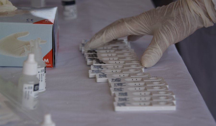 Τέλος τα δωρεάν rapid test του ΕΟΔΥ σε ανεμβολίαστους