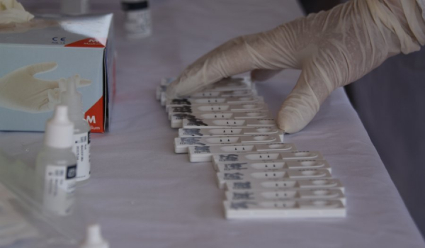 Τέλος τα δωρεάν rapid test του ΕΟΔΥ σε ανεμβολίαστους