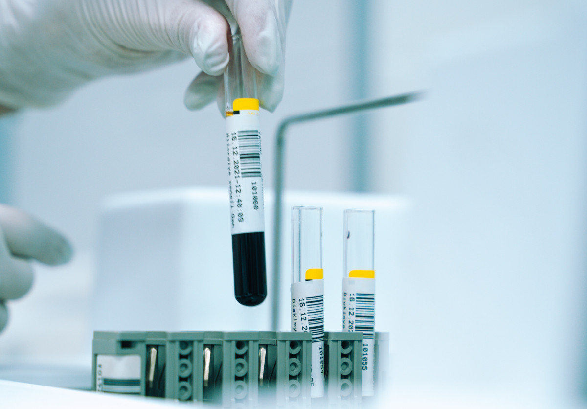 Πώς το τεστ αίματος Galleri ανιχνεύει 50 τύπους καρκίνου