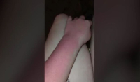 ΗΠΑ: Απίστευτο μαρτύριο για 14χρονη με αλλεργία στο νερό - Δεν βγαίνει ούτε στη βροχή (Βίντεο)