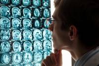 Έρευνα: Ένα να σοβαρό τραύμα στο κεφάλι αυξάνει τον κίνδυνο άνοιας ακόμα και μετά από δεκαετίες