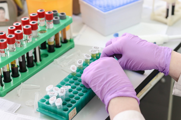 Κορονοϊός: Γονίδιο πιθανώς διπλασιάζει τον κίνδυνο θανάτου - Νέα ανακάλυψη