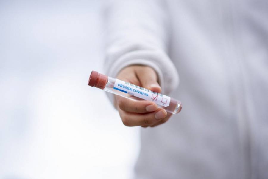 Κορονοϊός: Χωρίς «σοβαρές παρενέργειες» οι κλινικές δομικές του ρωσικού εμβολίου
