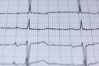 Iσχαιμική καρδιοπάθεια: Προσοχή στα πρώτα «αθώα» συμπτώματα