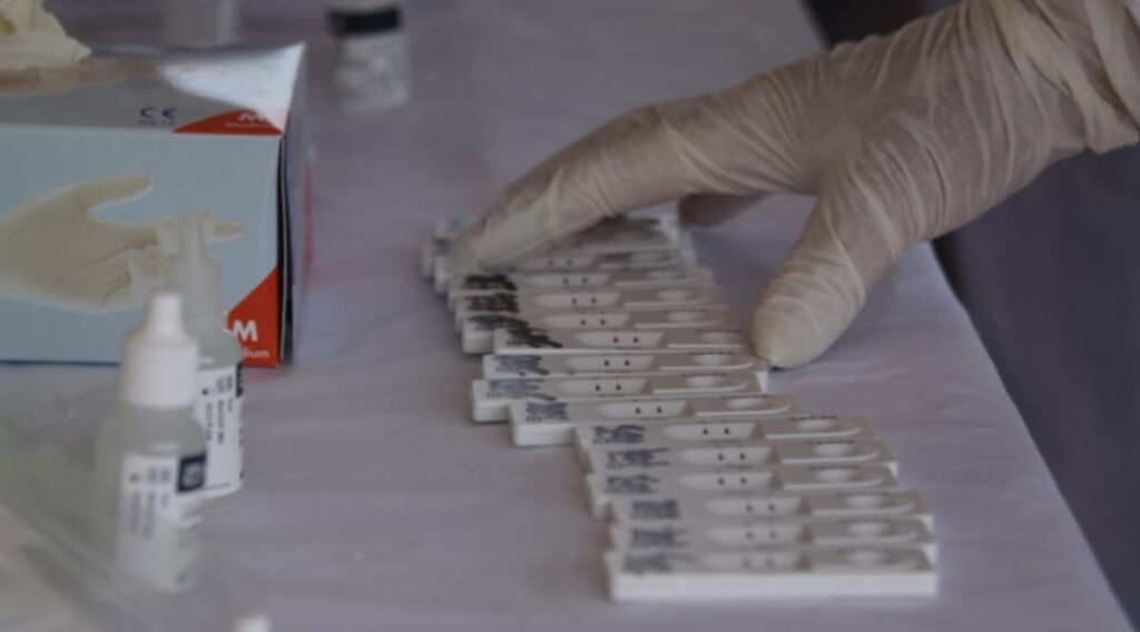 Πού γίνονται δωρεάν rapid test από τον ΕΟΔΥ την Παρασκευή 12/1