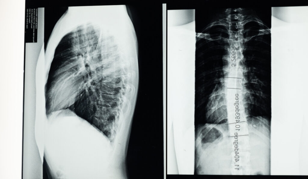 Τήνος: Πήγε για ακτινογραφία στο κτηνιατρείο γιατί δεν λειτουργούσε το ακτινολογικό στο Κέντρο Υγείας