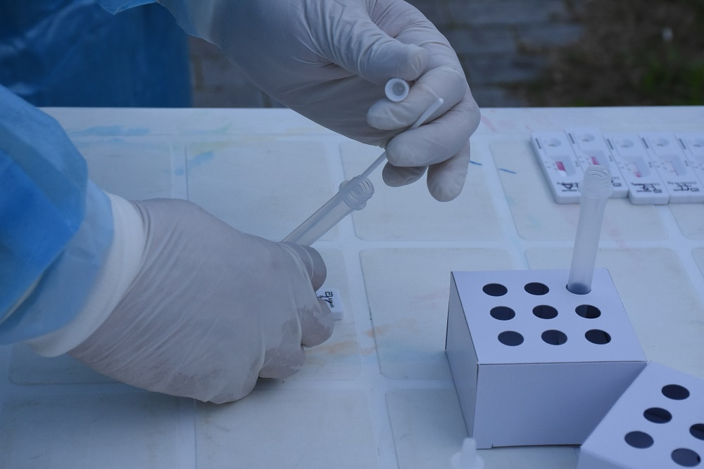 Κρούσματα σήμερα 2/2: 1.261 νέα, 652 στην Αττική – Ανακοίνωση ΕΟΔΥ
