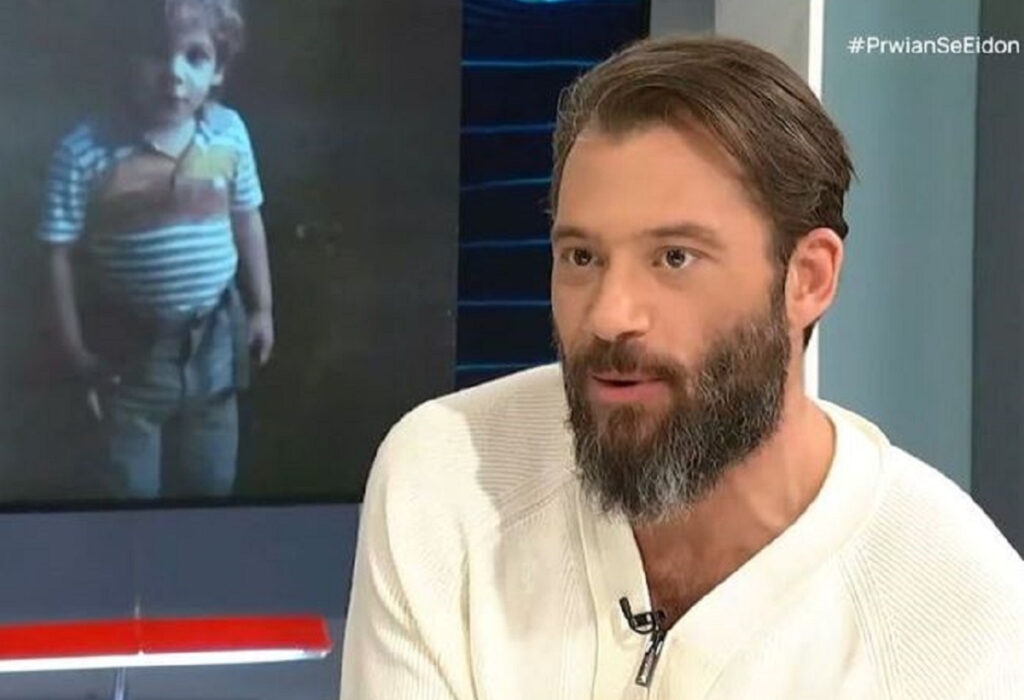 Αντίνοος Αλμπάνης: Πώς αποφάσισα να μιλήσω για τον καρκίνο