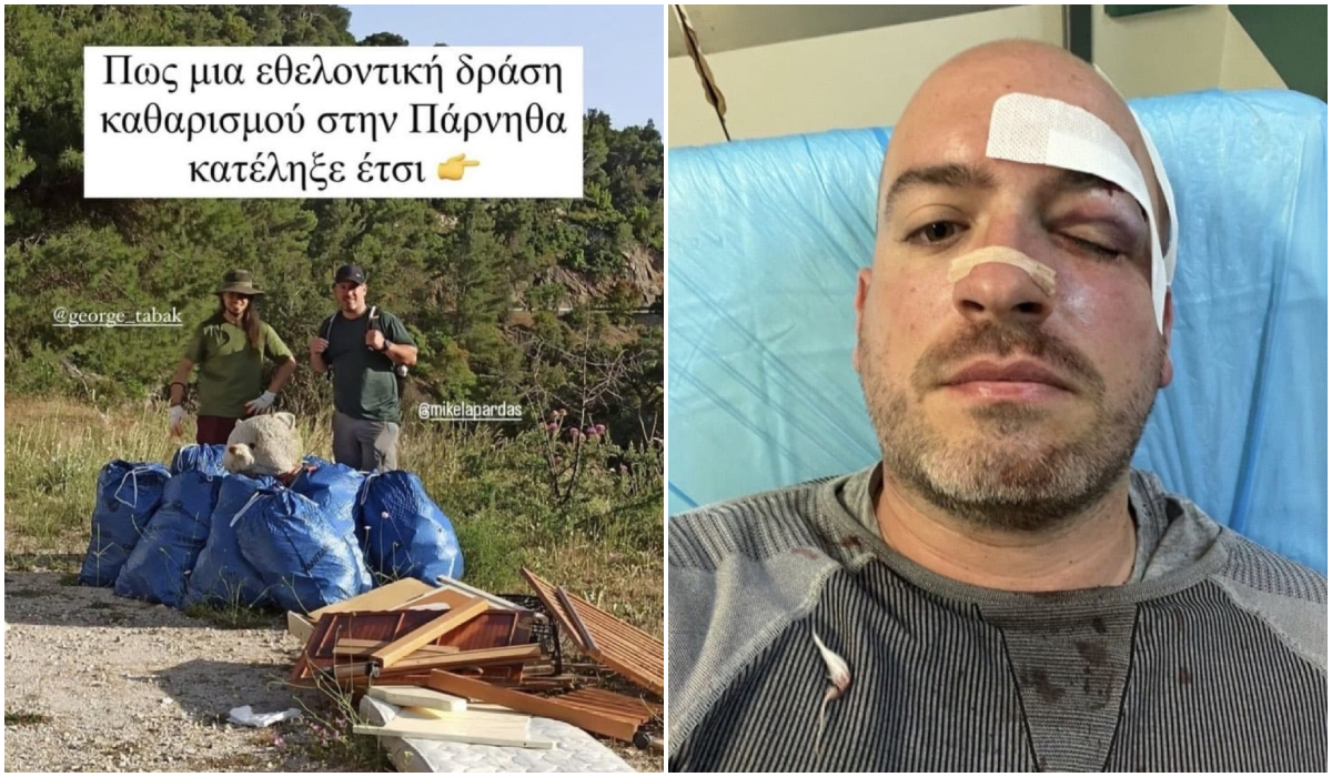 Πάρνηθα: Άγρια επίθεση σε εθελοντές που καθάριζαν την περιοχή – Τους ξυλοκόπησαν και τους μαχαίρωσαν