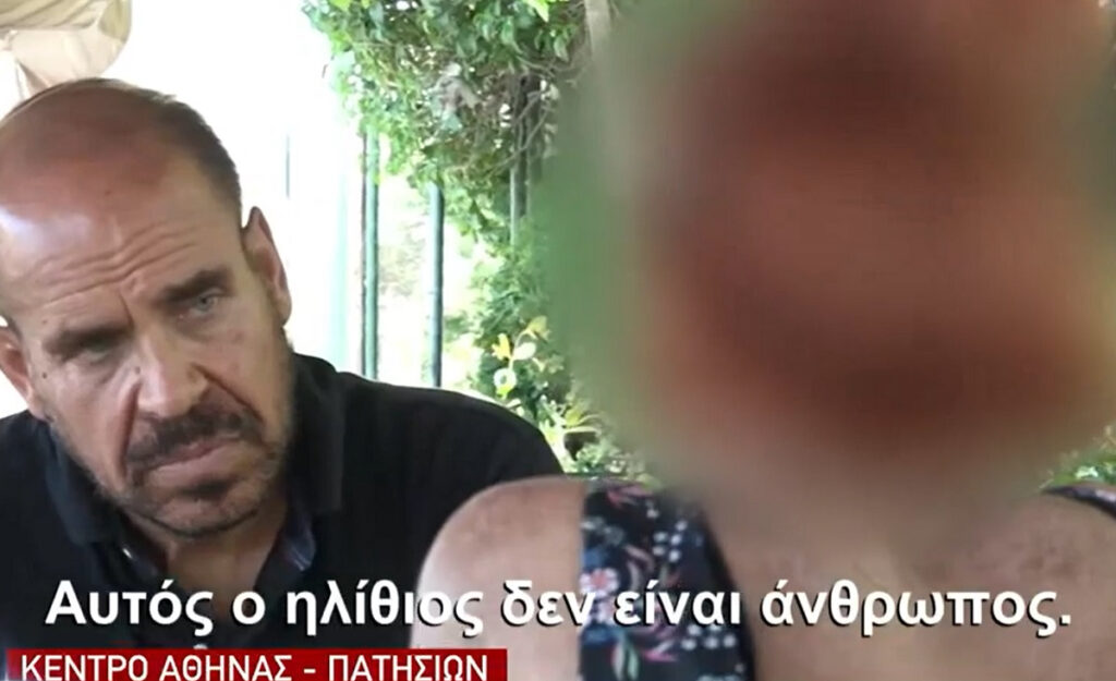 Ξεσπά 29χρονη θύμα βιασμού στην Πατησίων: «Αυτός ο ηλίθιος δεν είναι άνθρωπος»