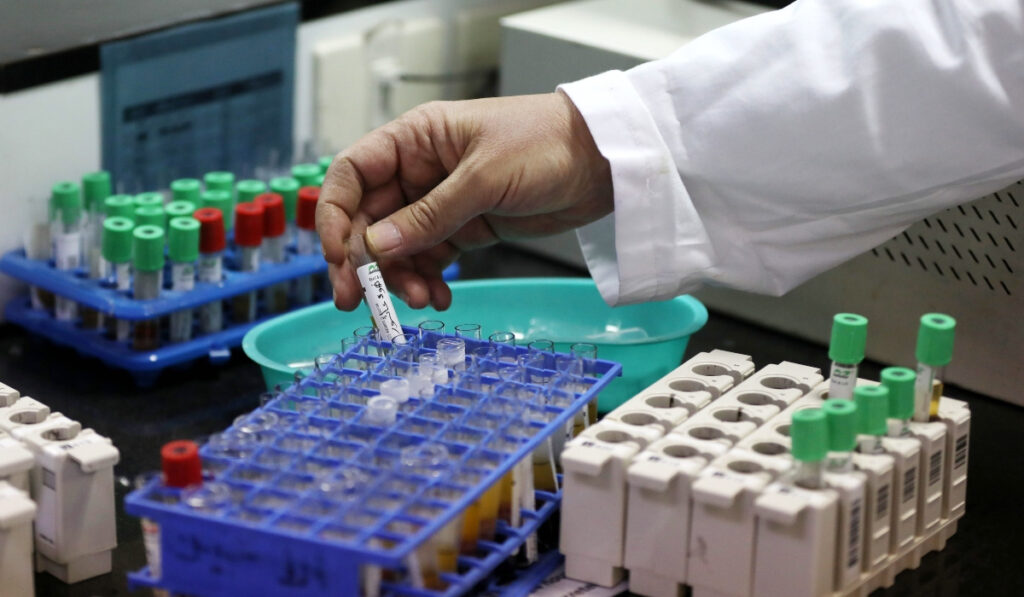 Ευλογιά των πιθήκων: Αυξάνονται τα κρούσματα στη Βρετανία – Ο ιός έφτασε σε Ουαλία και Β. Ιρλανδία