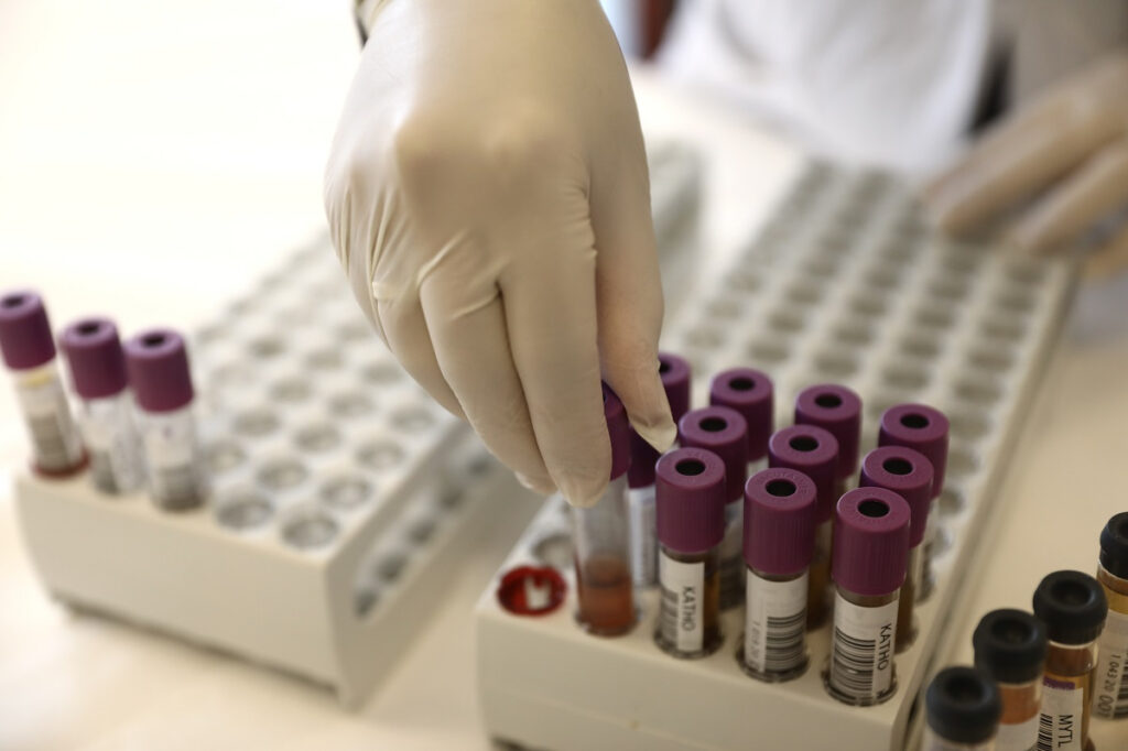 Μετάλλαξη Δέλτα: Θα επικρατήσει σε όλη την Ευρώπη έως τα τέλη Αυγούστου