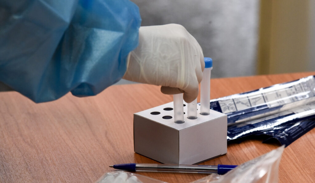 Rapid test: Πού γίνονται δωρεάν την Πέμπτη 23/2