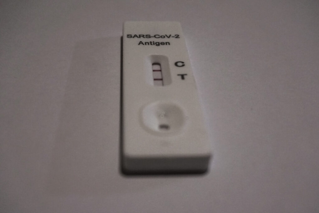 Πού γίνονται δωρεάν rapid test από τον ΕΟΔΥ την Πέμπτη 11/1