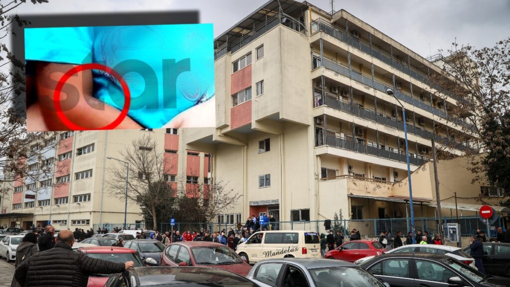 Λάρισα: «Δεν έπρεπε να έρθουμε, είδαν τις πληγές» - Ηχητικό «καίει» τη μητέρα για τα καψίματα στα παιδιά της